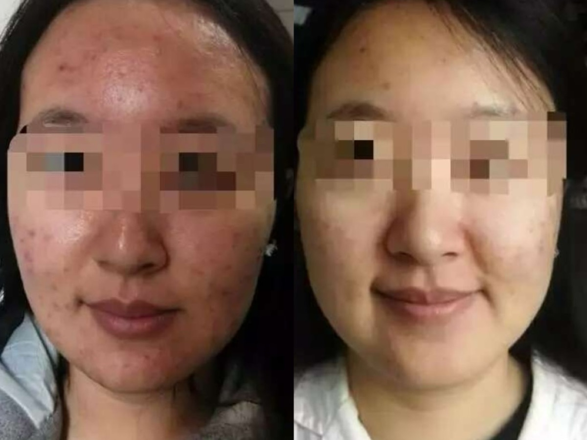 使用者反馈照片:案例 1,同一张照片内为使用前与使用后对比。