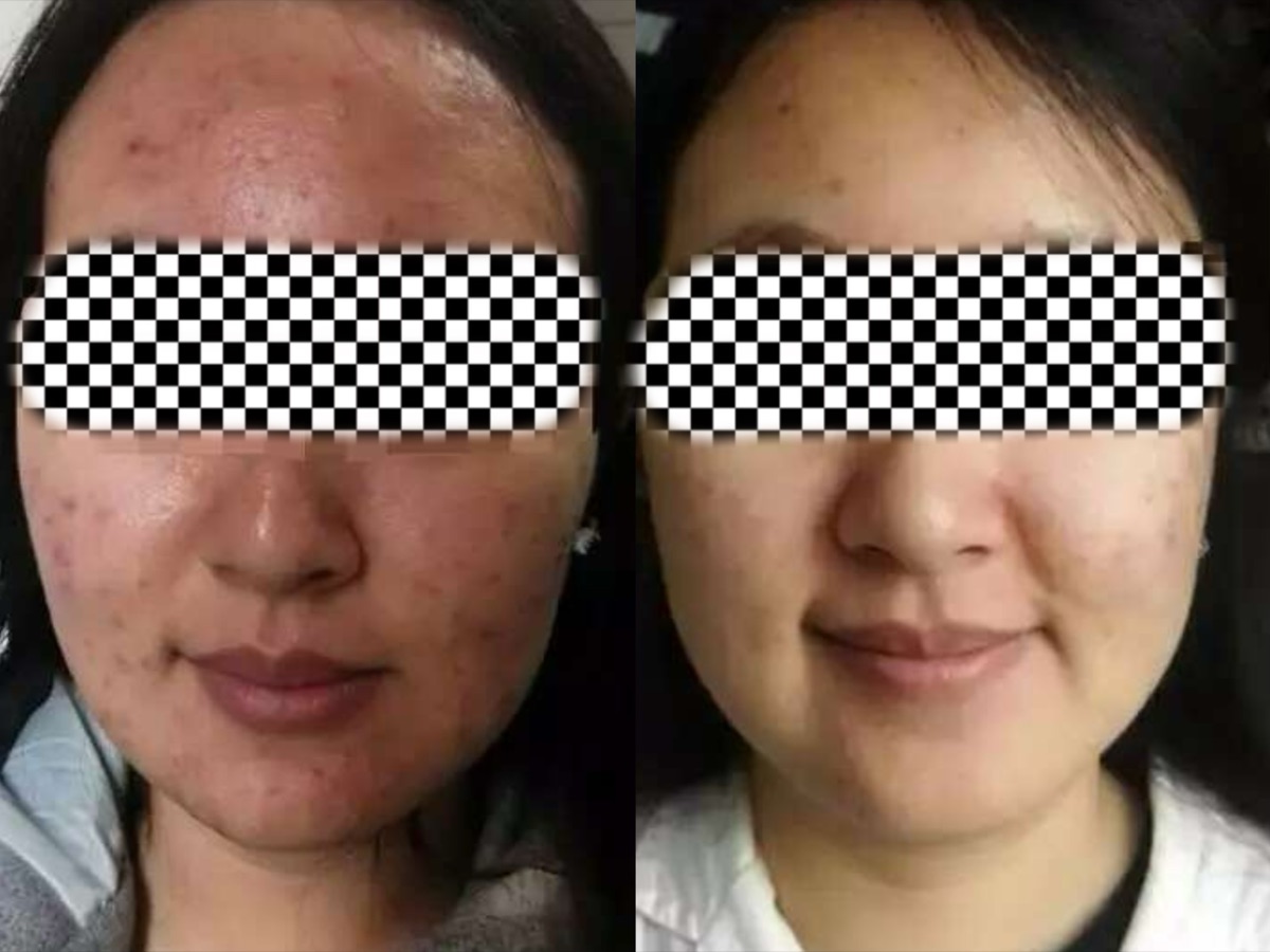 使用者反馈照片:案例 2,同一张照片内为使用前与使用后对比。
