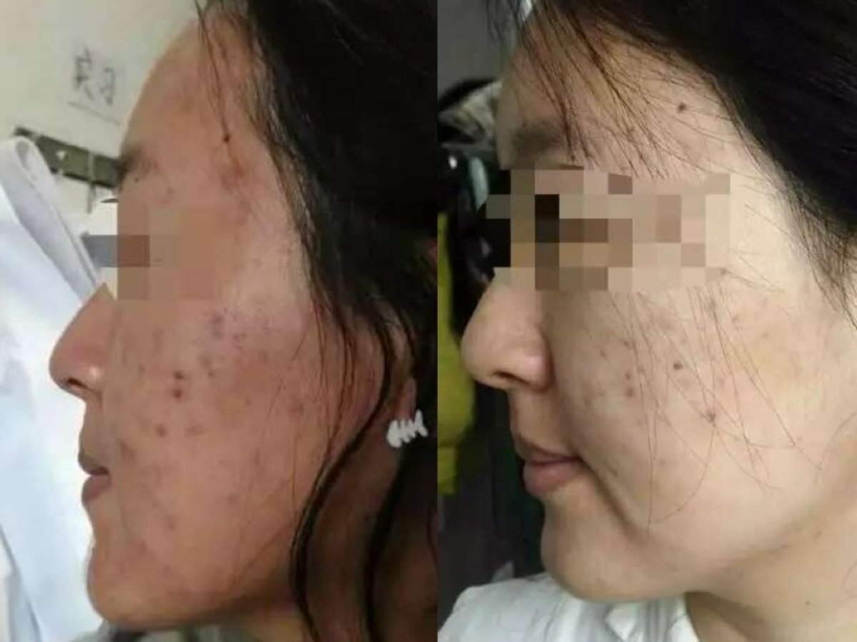 使用者反馈照片:案例 3,同一张照片内为使用前与使用后对比。