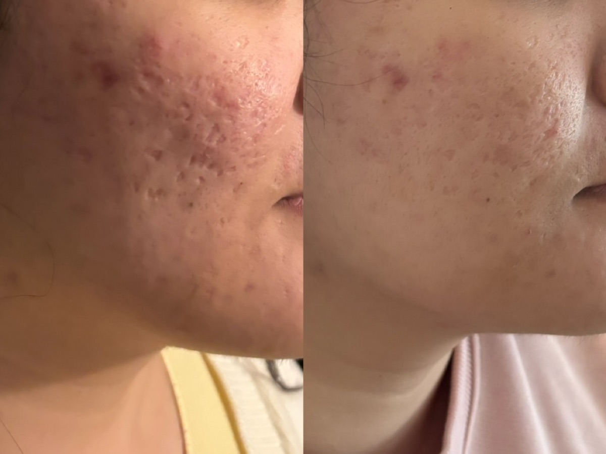使用者反馈照片:案例 4,同一张照片内为使用前与使用后对比。