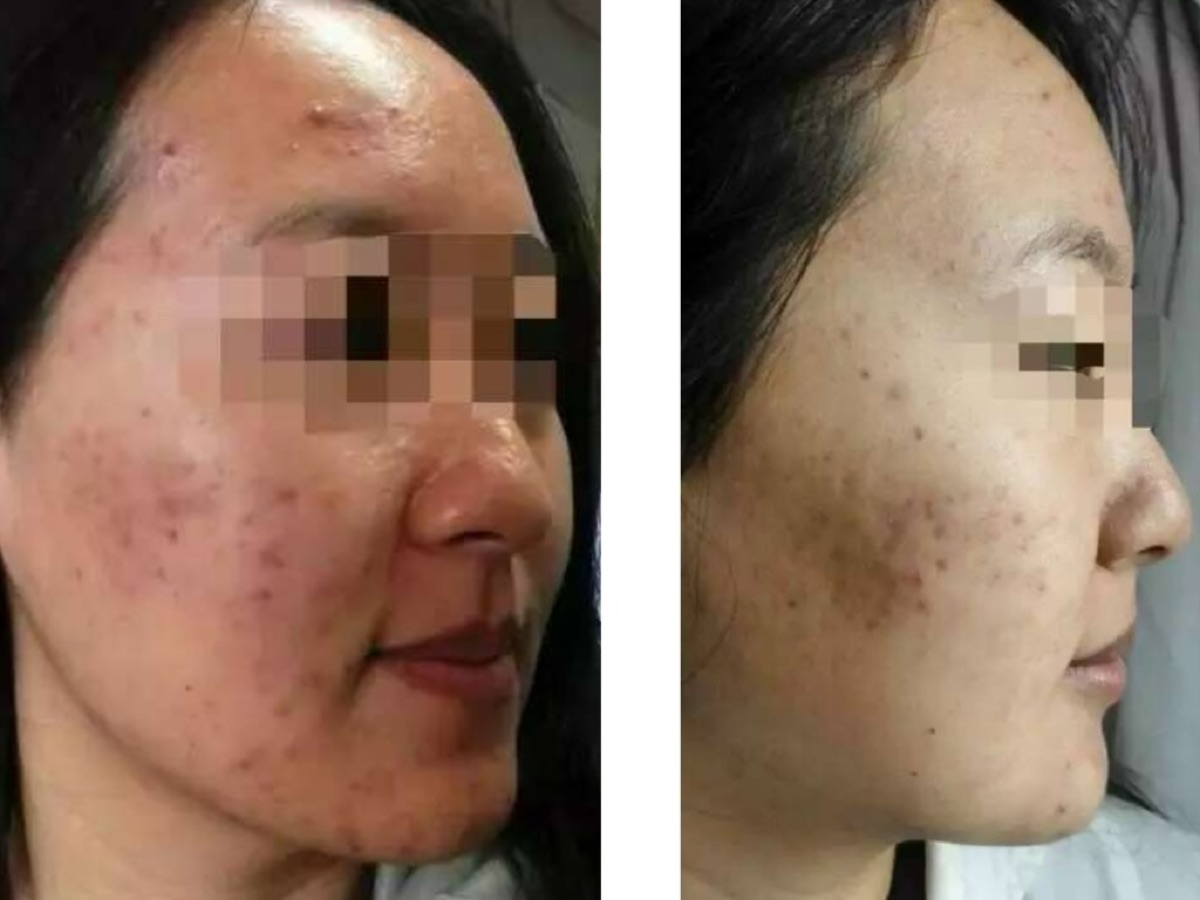 使用者反馈照片:案例 5,同一张照片内为使用前与使用后对比。