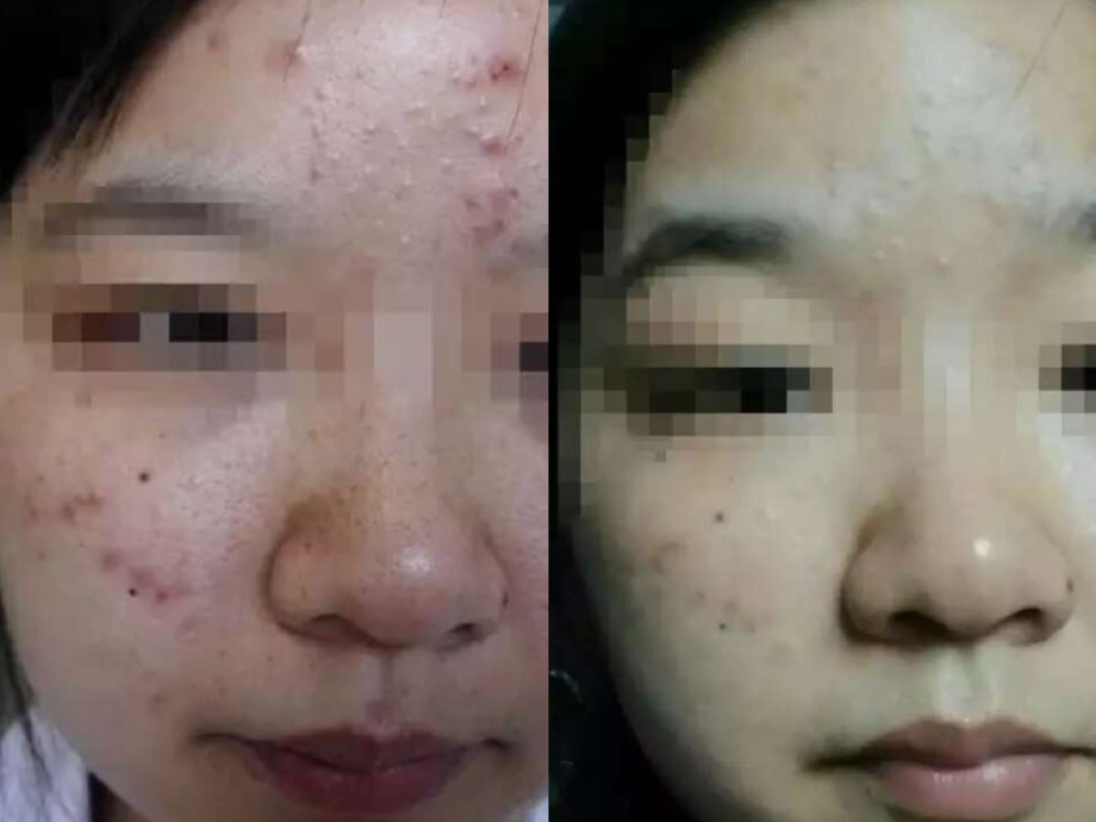 使用者反馈照片:案例 6,同一张照片内为使用前与使用后对比。