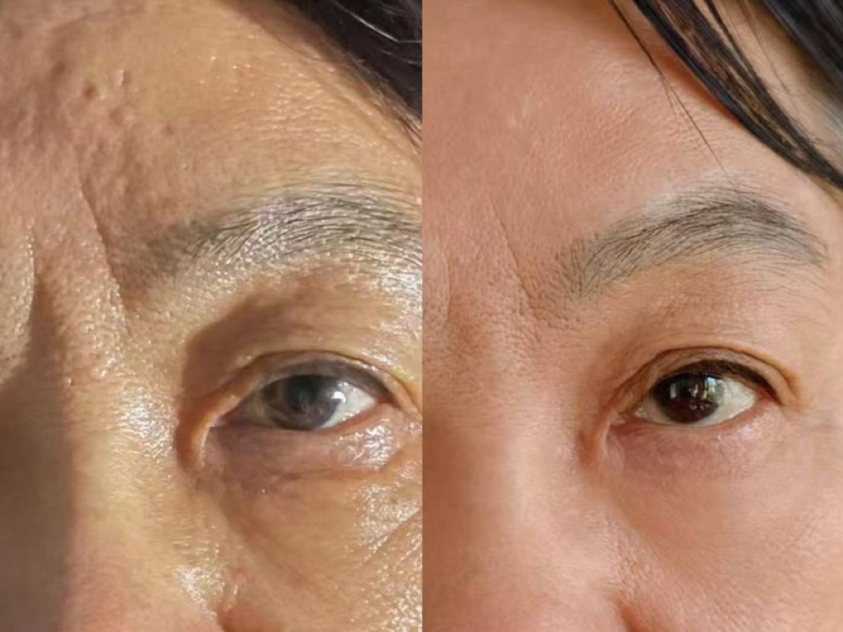 使用者反馈照片:案例 1,同一张照片内为使用前与使用后对比。