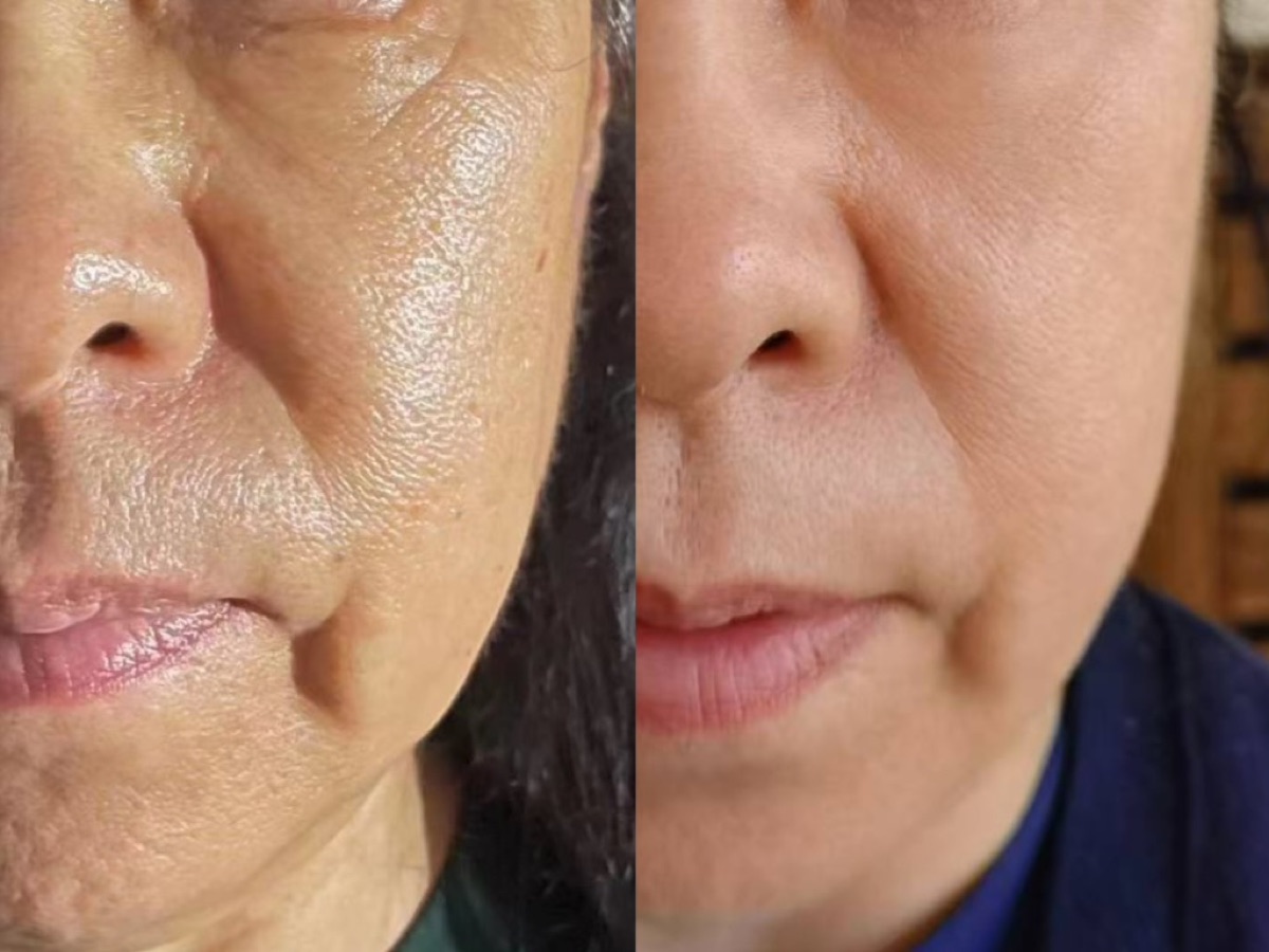 使用者反馈照片:案例 2,同一张照片内为使用前与使用后对比。
