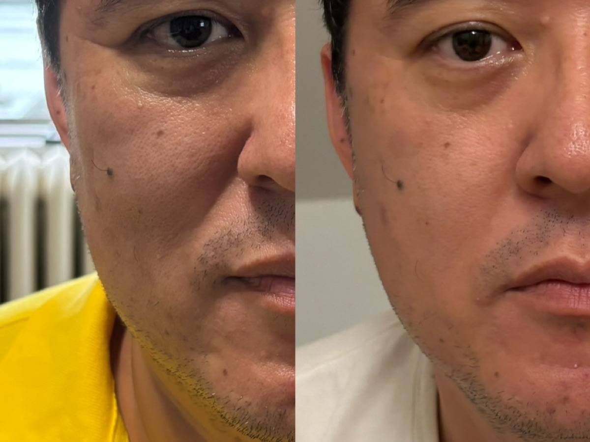 使用者反馈照片:案例 3,同一张照片内为使用前与使用后对比。