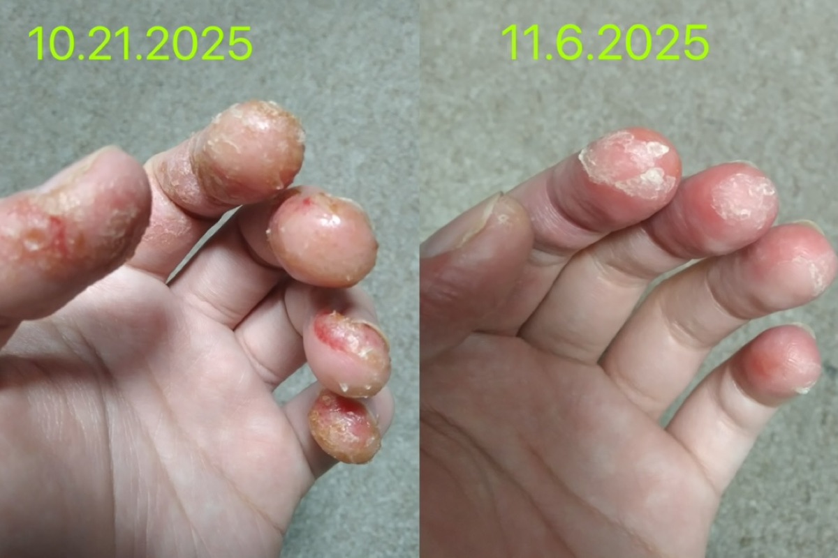 使用者反馈照片:案例 1,同一张照片内为使用前与使用后对比。
