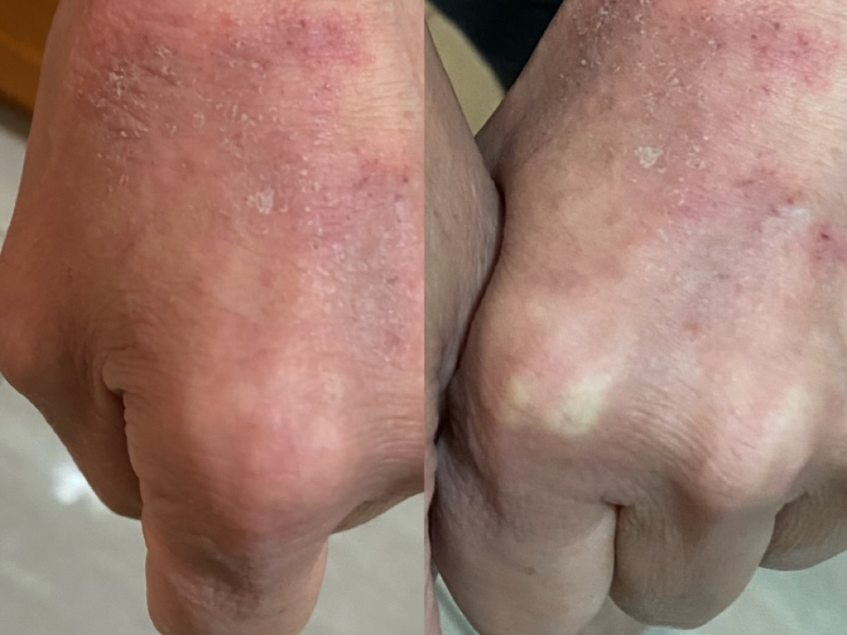 使用者反馈照片:案例 3,同一张照片内为使用前与使用后对比。