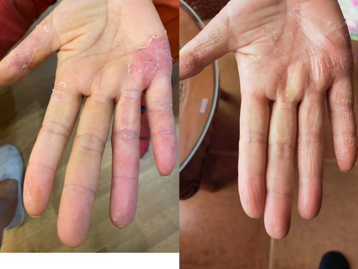 使用者反馈照片:案例 4,同一张照片内为使用前与使用后对比。